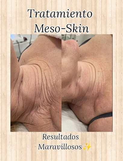 Venus | Centro de Estética en Priego de Córdoba