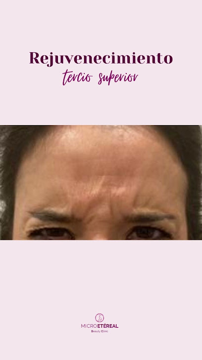 MicroEtereal Beauty Clinic | Centro de Estética en Madrid