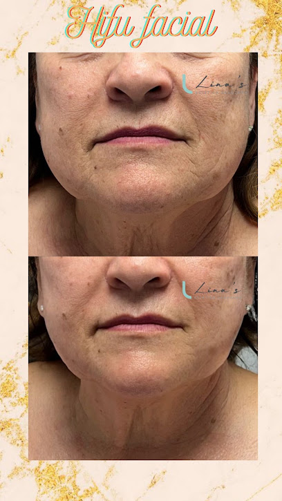 Lina’s Estética Avanzada | Centro de Estética en Palma