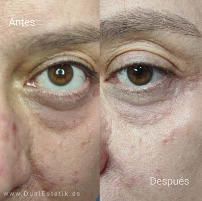 Camuflaje | Carolina Cespedes | Centro de Estética en Valencia
